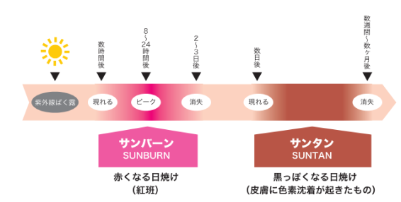 日焼けの種類