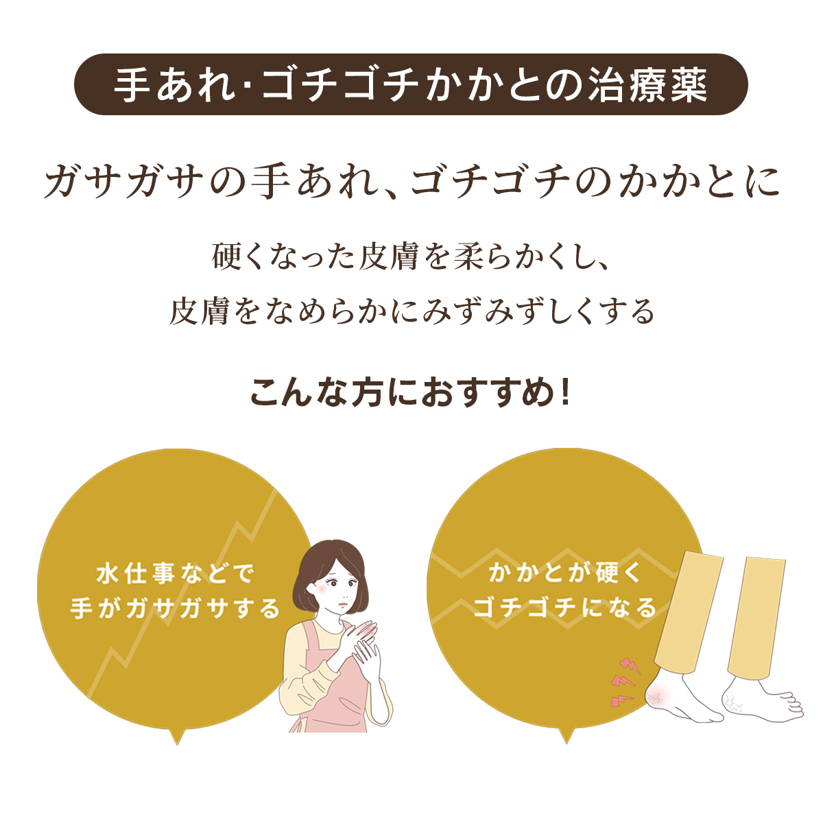 ケラチナミンコーワ20％尿素配合クリーム　150g【第3類医薬品】 150g