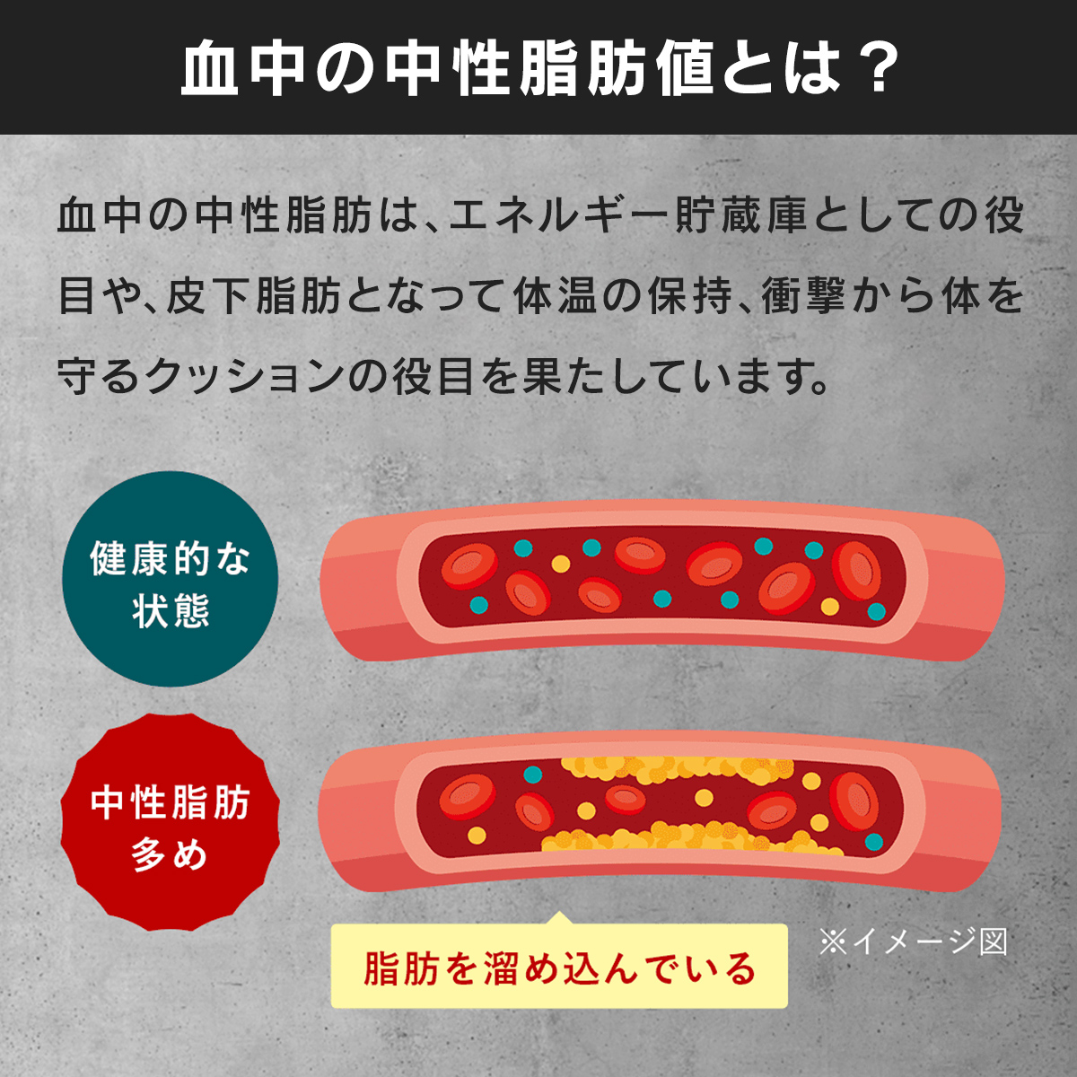 EPA・DHA　シームレスカプセル　30包【機能性表示食品】※ 1個